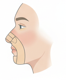 Dauer der Schmerzen nach einer Nasenoperation: Tag 1