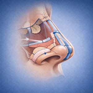 Spezialklinik f&uuml;r Nasenchirurgie &ndash; medizinisch-sachliche Darstellung der Nase