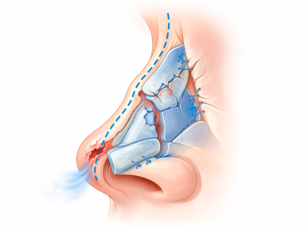 DR. Jurk - Hals-Nasen-Ohren Arzt, &Auml;sthetische Chirurgie in M&uuml;nchen